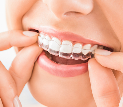 We offer Orthodontic treatment