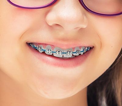 We offer Orthodontic treatment